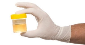 testul-de-urina